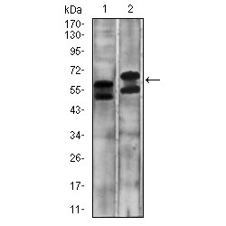 Carbonic Anhydrase 9 (CA9) Antibody