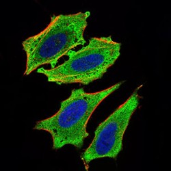 Carbohydrate-Responsive Element-Binding Protein (MLXIPL) Antibody
