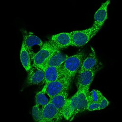 Cluster Of Differentiation 14 (CD14) Antibody