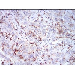 Cluster Of Differentiation 14 (CD14) Antibody