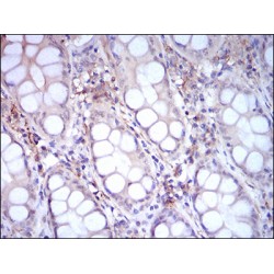 Cluster Of Differentiation 14 (CD14) Antibody