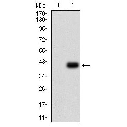 ATP-Dependent Translocase ABCB1 (ABCB1) Antibody