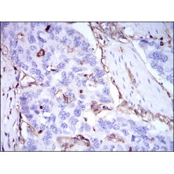 Beta-2-Microglobulin (B2M) Antibody