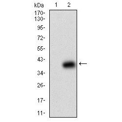 Beta-2-Microglobulin (B2M) Antibody
