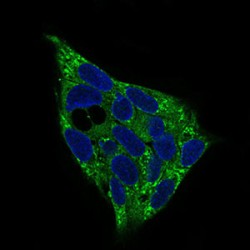 5'-AMP-Activated Protein Kinase Subunit Gamma-1 (PRKAG1) Antibody