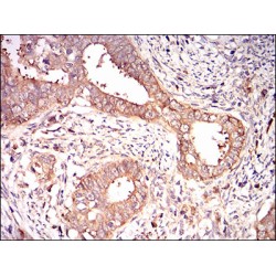 Eukaryotic Translation Initiation Factor 2A, 65 kDa (EIF2A) Antibody