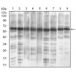 Eukaryotic Translation Initiation Factor 2A, 65 kDa (EIF2A) Antibody