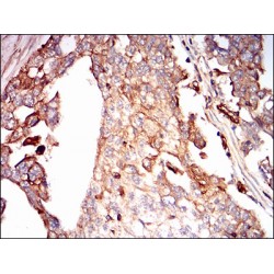 Syndecan 1 (SDC1) Antibody