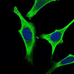 Gamma-Aminobutyric Acid Type B Receptor Subunit 2 (GABBR2) Antibody