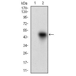 Tyrosine-Protein Kinase Transmembrane Receptor ROR2 (ROR2) Antibody