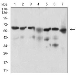 Beta-Secretase 1 (BACE1) Antibody