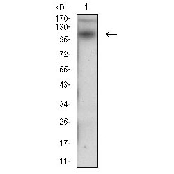 Desmoglein 3 (DSG3) Antibody