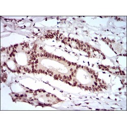 KH Domain-Containing, RNA-Binding, Signal Transduction-Associated Protein 2 (KHDRBS2) Antibody