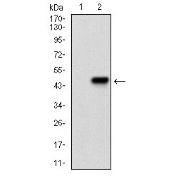 Protein Kinase, cAMP Dependent Catalytic Alpha (PRKACA) Antibody