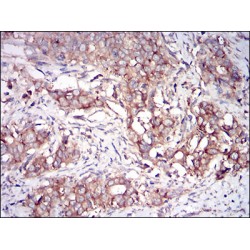 Interferon-Induced, Double-Stranded RNA-Activated Protein Kinase (EIF2AK2) Antibody