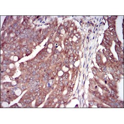 Interferon-Induced Double Stranded RNA-Activated Protein Kinase (EIF2AK2) Antibody