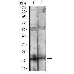 Bcl2-Associated Agonist Of Cell Death (BAD) Antibody