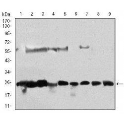 Casein Kinase II Subunit Beta (CSNK2B) Antibody