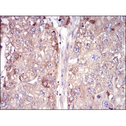 Vitronectin (VTN) Antibody