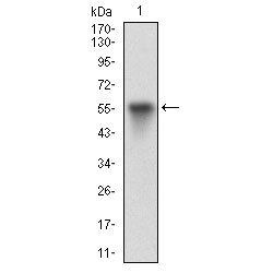 Vitronectin (VTN) Antibody