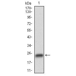Glycogen Synthase Kinase 3 Beta (GSK3B) Antibody