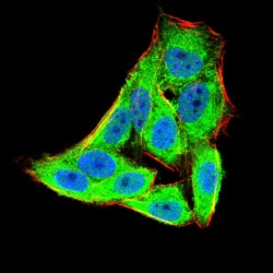 Eukaryotic Translation Initiation Factor 5A-1 (EIF5A) Antibody