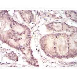 Eukaryotic Translation Initiation Factor 5A-1 (EIF5A) Antibody