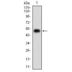 Serine/Threonine-Protein Kinase N1 (PKN1) Antibody