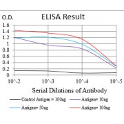 Fig. 1. Black line: Control Antigen (100 ng); Purple line: Antigen(10ng); Blue line: Antigen (50 ng); Red line: Antigen (100 ng)