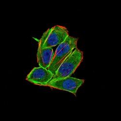 Platelet Derived Growth Factor Receptor Alpha (PDGFRA) Antibody