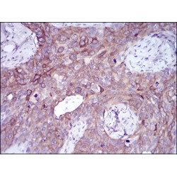 Snail Family Transcriptional Repressor 2 / SLUG (SNAI2) Antibody