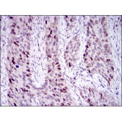 Histone Deacetylase 10 (HDAC10) Antibody
