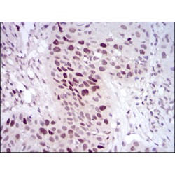 Histone Deacetylase 10 (HDAC10) Antibody