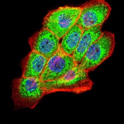 Fibrocystin (PKHD1) Antibody