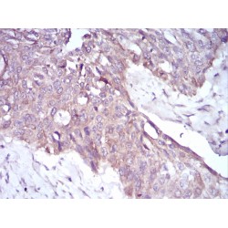 Fibrocystin (PKHD1) Antibody