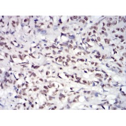 Tyrosine-Protein Kinase JAK2 (JAK2) Antibody