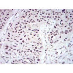 Pre-mRNA-Splicing Regulator WTAP (WTAP) Antibody