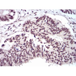 Pre-mRNA-Splicing Regulator WTAP (WTAP) Antibody