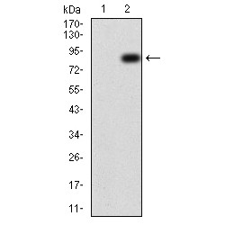 60 kDa Tat-Interactive Protein (TIP60) Antibody