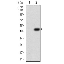 Tubulin Beta 1 (TUBB1) Antibody