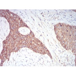 Alpha Adducin (ADD1) Antibody