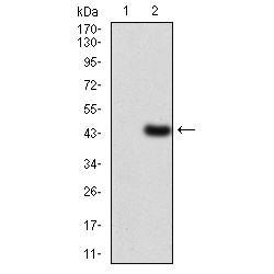 Low Density Lipoprotein Receptor (LDLR) Antibody