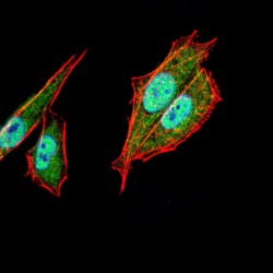 Transcription Factor AP-2-Alpha (TFAP2A) Antibody