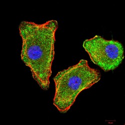 Transthyretin (TTR) Antibody