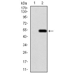 Absent In Melanoma 2 (AIM2) Antibody