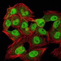 Chromobox Protein Homolog 1 (CBX1) Antibody