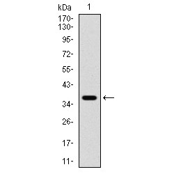 Phosphoinositide Dependent Protein Kinase 1 (PDPK1) Antibody