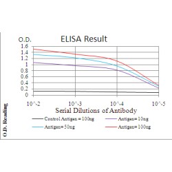 Telomerase Reverse Transcriptase (TERT) Antibody