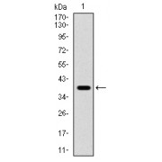 Western blot analysis of recombinant Human TERT (1029-1132aa) using Telomerase Reverse Transcriptase (TERT) Antibody.
