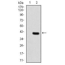 Telomerase Reverse Transcriptase (TERT) Antibody